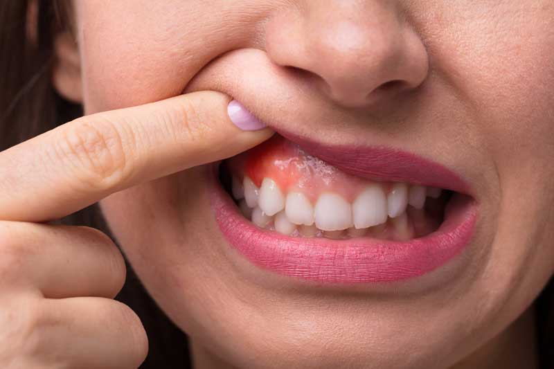 Girl is Showing a Her Painful Tooth