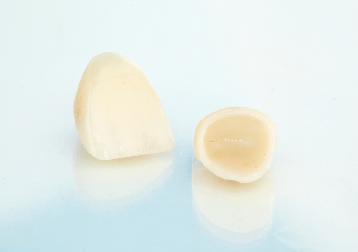Crowns for Your Teeth in Lancaster, CA area